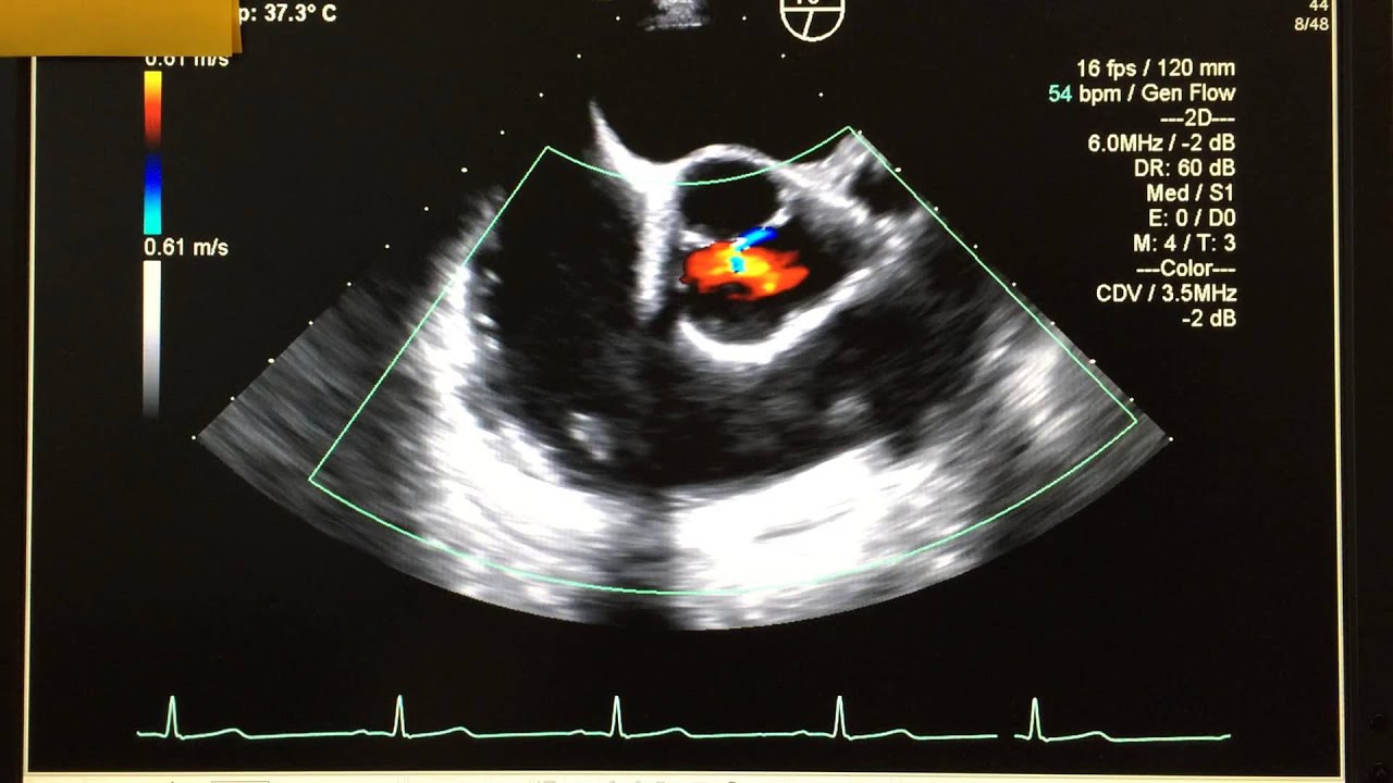 Case Journal Echo At Katherine Edmunds Blog