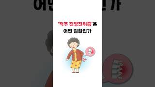 '척추 전방전위증' 어떤 질환일까? [허리통증]