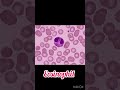 differential leukocyte count wbc dlc microscopy viralvideos hematology