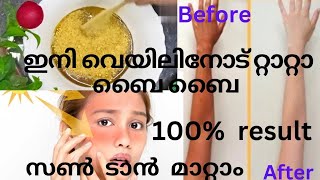 സൺ ടാൻ മാറ്റാം വെറും ഒരാഴ്ചയിൽ/Home remedy for Sun tan/100% result#homeremedy#discoversakalakala#vid