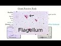 bacillus anthracis vs bacillus cereus