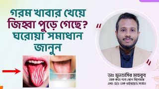 গরম খাবারে জিহ্বা পুড়ে গেলে করণীয়। জিহ্বা পুড়ে গেলে ঘরোয়া করণীয়। চা-কফিতে জিহ্বা পুড়েছে?