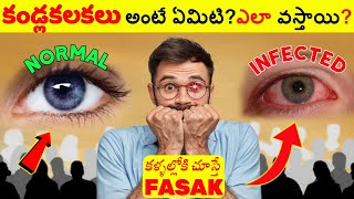 కండ్లకలక ఎలా వస్తుంది?Conjunctivitis?| Top 20 Interesting Facts in Telugu| Telugu Facts| Madhu Facts