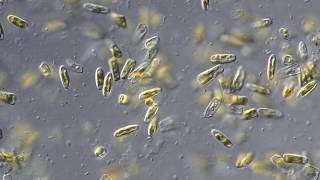 Diatoms live culture