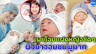 ชมความน่ารักแบบชัดๆ ลูกสาวฝาแฝด บีม-ออย ผิวขาวอมชมพูมาก