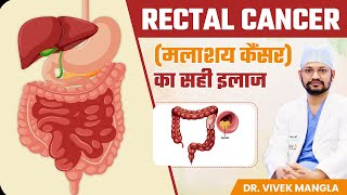 जानिए Rectal Cancer (मलाशय कैंसर) का सही इलाज | Best Treatment of Rectal Cancer | Dr. Vivek Mangla