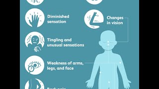 Acute Disseminated Encephalomyelitis