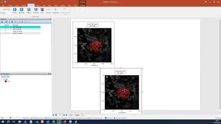 Getting Started with FCS Express 7 Image Cytometry