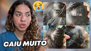 COMO FIZ O MEU CABELO PARAR DE CAIR | FIQUEI COM VÁRIAS FALHAS NO COURO CABELUDO! 😭😭😭