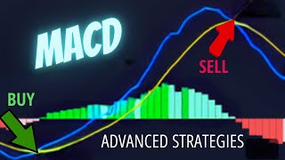 MACD Advanced Trading Strategies for More Wins🚀💥