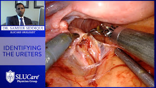 Robotic Cystectomy Procedure To Remove Bladder  - SLUCare Urology