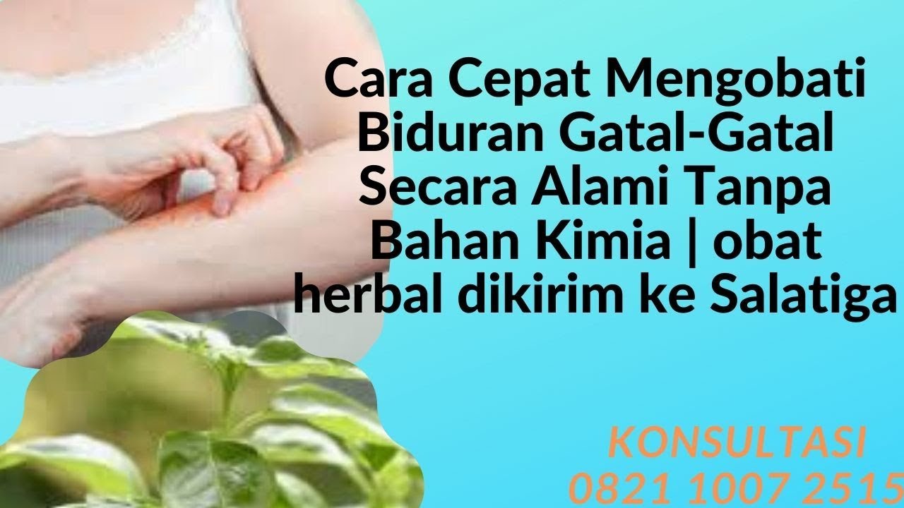 Cara Mengobati Biduran Gatal Secara Alami Tanpa Bahan Kimia | Obat ...