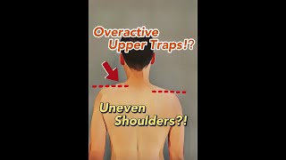 My Shoulders are Uneven! Let's talk about the Upper Traps