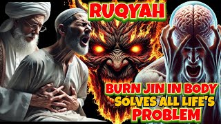 Burn the Jinn and Satan that disturb your body with Ruqyah