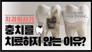 진짜 급한 충치는 따로있다? 치과 의사들이 충치 치료를 미루는 이유