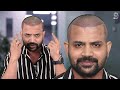 youtuber topa bhai nadeem bunny new look before u0026 after hair transplant