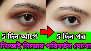 চোখের নিচের কালো দাগ দূর করার উপায়/Under eye dark circle/ Dark circle remove/Beauty Highlighting