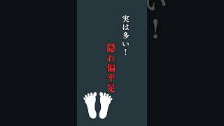 アーチが潰れてる、扁平足は外反母趾や膝痛の原因になる