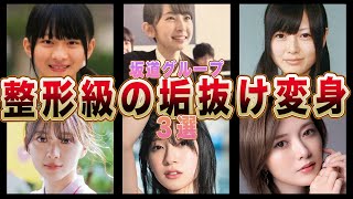 【3坂道】整形級に垢抜けたメンバー３選(白石麻衣,森田ひかる,金村美玖)【乃木坂46・欅坂46・けやき坂46】