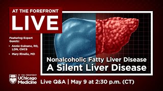 Nonalcoholic Fatty Liver Disease - A Silent Liver Disease - Expert Q&A