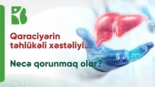 Qaraciyər Sirrozundan xilas olmaq mümkündür? İnteqrativ Tibbdə necə müalicə olunur?