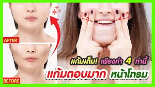 แก้มตอบ โหนกแก้มสูง ทำไงดี? 4 วิธีช่วยเพิ่มแก้มอิ่มเต็มดูสดใส (แนะนำวิธีแก้ถาวร ไม่ฉีดฟิลเลอร์ไขมัน)