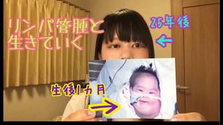 【自己紹介】リンパ管腫と生きています