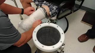 Union Orthotics \u0026 Prosthetics Co.: Using The Romedis Symphonie Prosthetic Socket Casting System