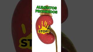 Alimentos Prohibidos para Piedras de Riñón