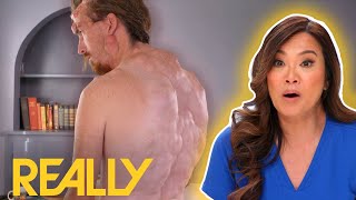 "I Have Over 400 Tumours On My Body" | Dr Pimple Popper