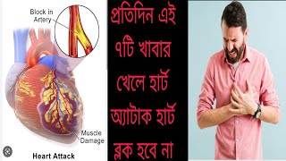 ৭টি খাবার প্রতিদিন নিয়ম করে খেলে আজীবন হার্ট অ্যাটাক, হার্ট ব্লক হবে না।।১০০% গ্যারান্টি