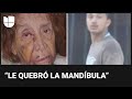 Anciana es brutalmente golpeada por un presunto agresor en serie