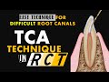 TCA TECHNIQUE | COMPLICATED ROOT CANAL TREATMENT MADE EASY