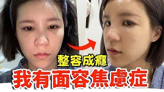 我好自卑！整形成癮讓我停不下來...｜技安 ft.李羽榛諮商心理師