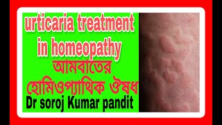 Urticaria treatment। homeopathy। আমবাতের হোমিও ঔষধ। আমবাত কি কেন হয়