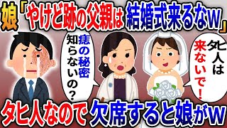 【2ch修羅場スレ】愛娘の結婚式に出席しようとしたら「やけど跡の親父はタヒんだことにしてるから来るな」と追い返された→嫁「あなた知らないの？」娘「え？」タヒ人なので黙って出ていくと娘がw