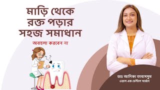 দাঁতের মাড়ি থেকে রক্ত পড়া ও সমাধান। daater mari theke rokto pore. Dental Calculus Disease