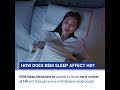 REM sleep with Huntington's Disease