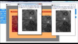 Project on Digital Image Processing Using Matlab | Thesis on Digital Image Processing Using Matlab