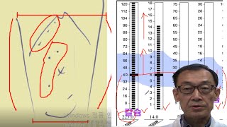 이명, 뇌명증, 난청, 불면증, 이명치료,뇌명치료, 난청 치료, 불면증 치료