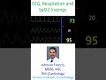 ECG, Respiration and SpO2 tracings