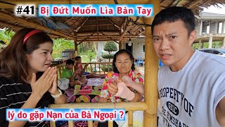 #41 Bà Ngoại Gặp Nạn, Đứt Muốn Lìa Bàn Tay Và Nguyên Nhân Gây Choáng - DuyNisa