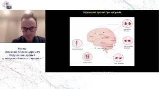 Нарушение зрения у неврологического пациента. д.м.н., проф. Кулеш А.А.
