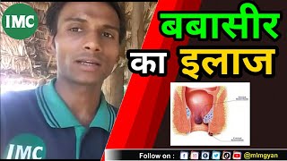 Imc में बबासीर का इलाज | Babasir ki daba | Babasir treatment | Babasir ka ilaj | piles treatment