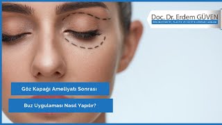 Göz Kapağı Ameliyatı Sonrası Buz Uygulaması Nasıl Yapılır? | Göz kapağı | Doç. Dr. Erdem Güven