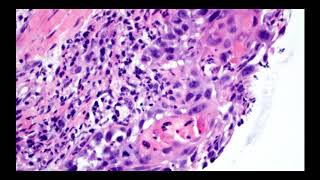 Cases with Dr Keeney: Case #4