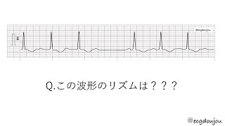12/3心電図道場解説