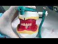 Dentiscope | Arranging Upper and Lower Anterior Teeth