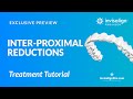 IPR with Invisalign Treatment