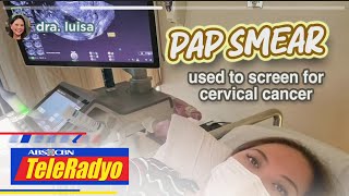 Bakit mahalaga ang Pap smear test? | Your Daily Do's (25 Feb 2023)